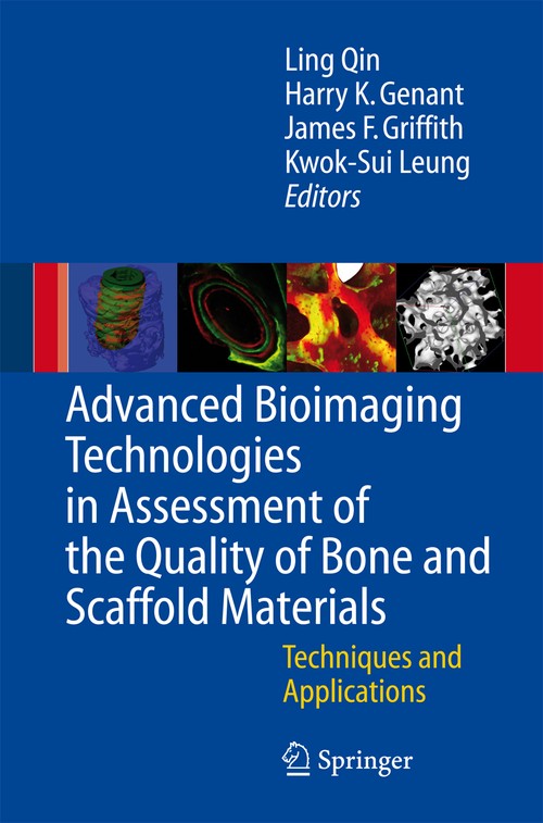 Advanced Bioimaging Technologies in Assessment of the Quality of Bone and Scaffold Materials by L Qin | ISBN-13 9783642079559