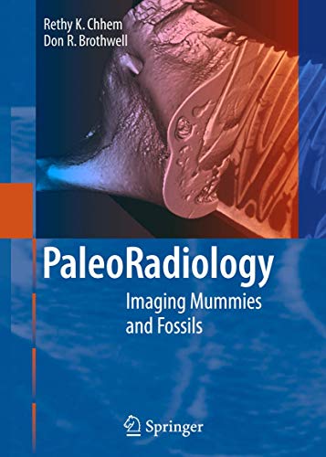 Paleoradiology by Rk Chhem | ISBN-13 9783642080241