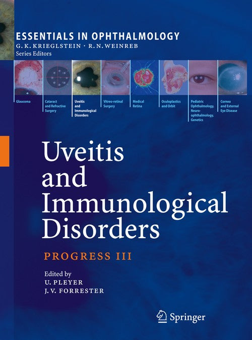 Uveitis and Immunological Disorders by Uwe Pleyer | ISBN-13 9783642088971