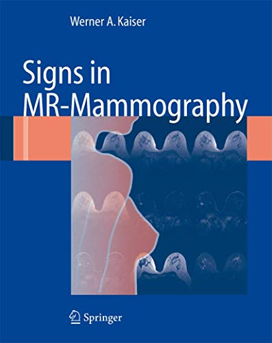 Signs in MR-Mammography by Werner A Kaiser | ISBN-13 9783642092336