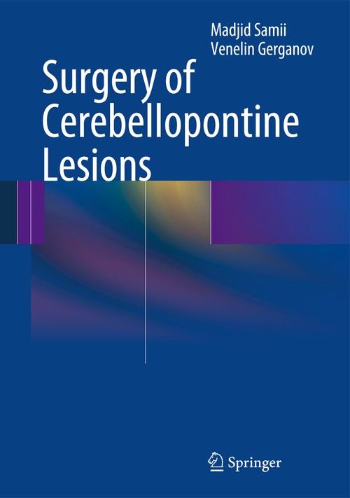 Surgery of Cerebellopontine Lesions by Madjid Samii | ISBN-13 9783642354212