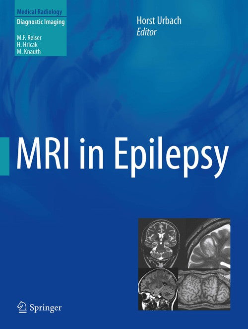 MRI in Epilepsy by Horst Urbach | ISBN-13 9783642438417