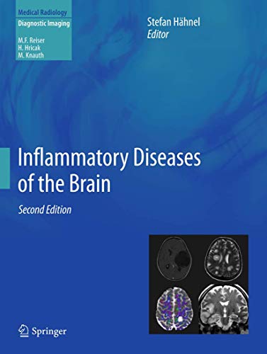 Inflammatory Diseases of the Brain by Stefan Hhnel | ISBN-13 9783642440847