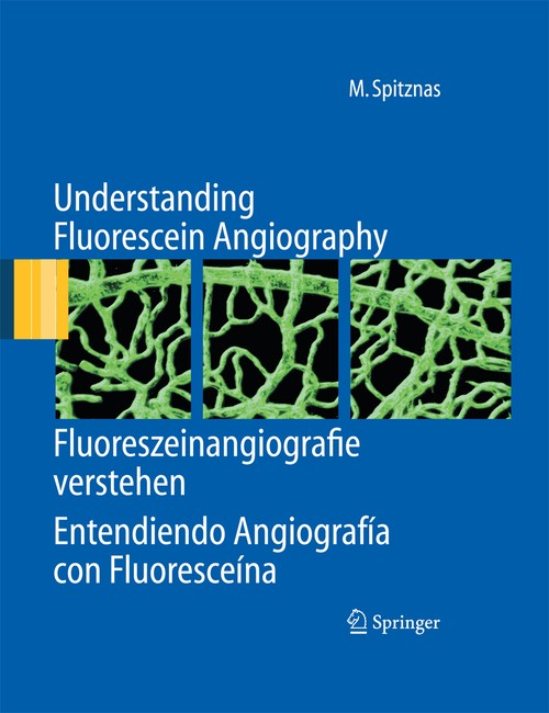 Understanding Fluorescein Angiography, Fluoreszeinangiografie verstehen, Entendiendo Angiografía con Fluoresceína by Manfred Spitznas | ISBN-13 9783642440854
