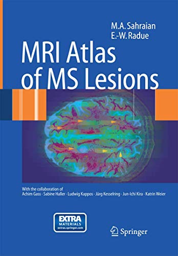 MRI Atlas of MS Lesions by Ma Sahraian | ISBN-13 9783642447815