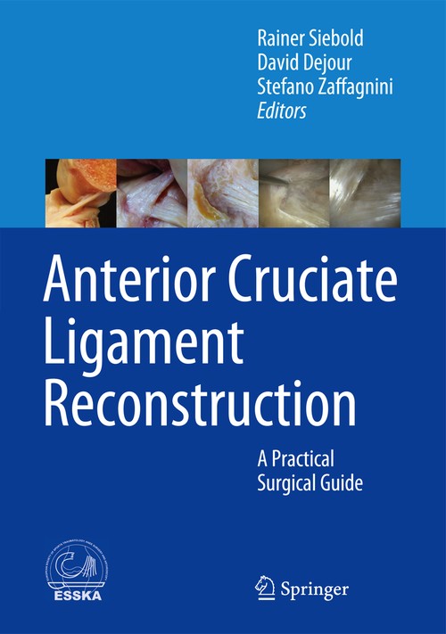 Anterior Cruciate Ligament Reconstruction by Rainer Siebold | ISBN-13 9783642453489