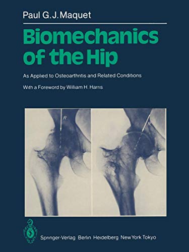 Biomechanics of the Hip by Pgj Maquet | ISBN-13 9783642509629