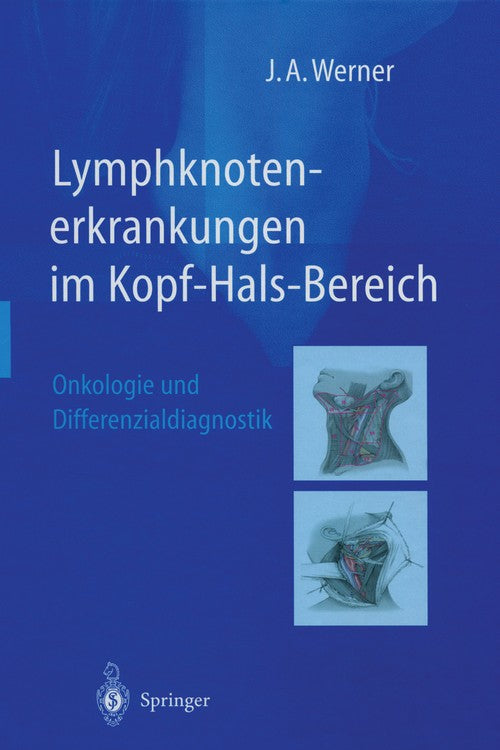 Lymphknotenerkrankungen im Kopf-Hals-Bereich by Jochen A Werner | ISBN-13 9783642627606