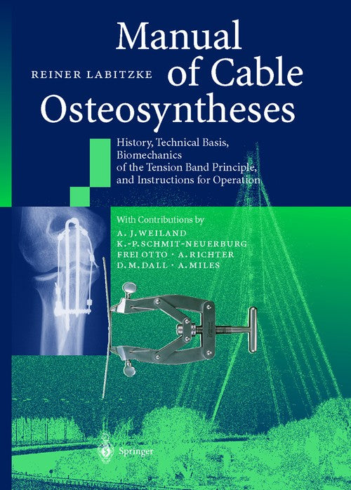 Manual of Cable Osteosyntheses by Reiner Labitzke | ISBN-13 9783642630590