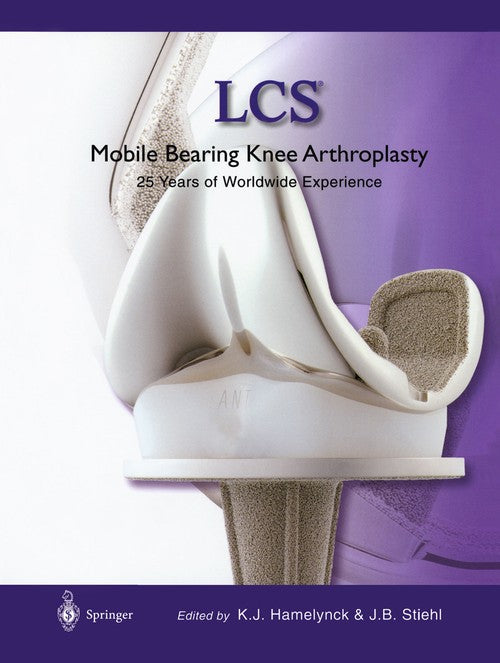 LCS (R) Mobile Bearing Knee Arthroplasty by Karel J Hamelynck | ISBN-13 9783642639449