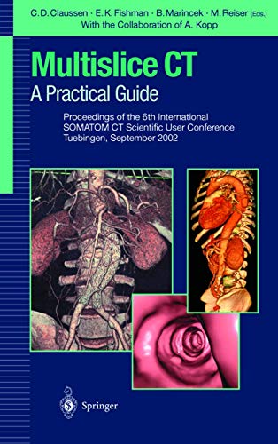 Multislice CT: A Practical Guide by B Marincek | ISBN-13 9783642639791