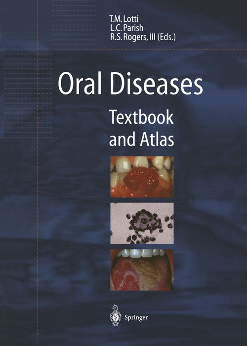 Oral Diseases by Torello M Lotti | ISBN-13 9783642641381