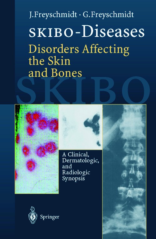 SKIBO-Diseases Disorders Affecting the Skin and Bones by Jrgen Freyschmidt ISBN 9783642641596