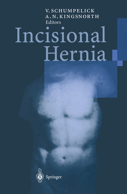 Incisional Hernia by Volker Schumpelick | ISBN-13 9783642642678