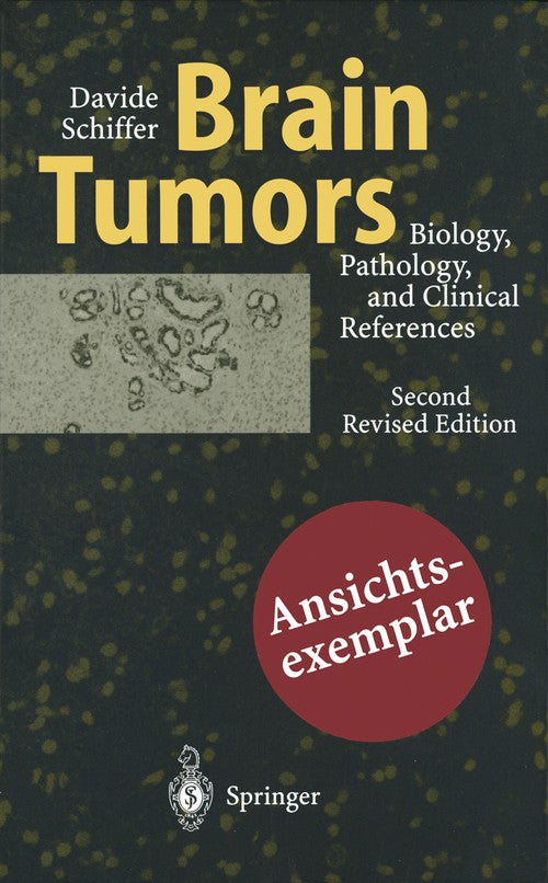Brain Tumors by Mt Giordana | ISBN-13 9783642644450