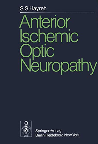 Anterior Ischemic Optic Neuropathy by Ss Hayreh | ISBN-13 9783642659591