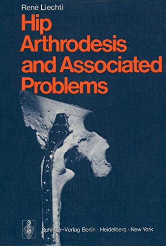 Hip Arthrodesis and Associated Problems by R Liechti | ISBN-13 9783642668753