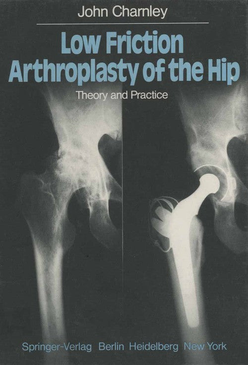 Low Friction Arthroplasty of the Hip by J Charnley | ISBN-13 9783642670152