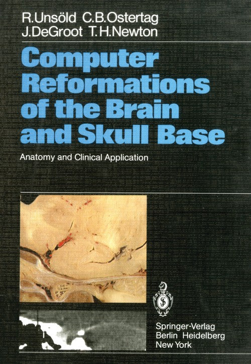 Computer Reformations of the Brain and Skull Base by C Ostertag