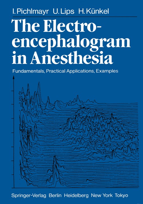 The Electroencephalogram in Anesthesia by I Pichlmayr | ISBN-13 9783642695643