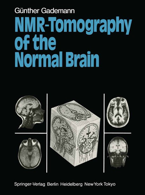 NMR-Tomography of the Normal Brain by Gnther Gademann | ISBN-13 9783642696220