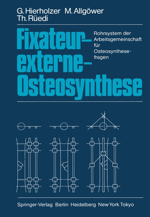 Fixateur-externe-Osteosynthese by G Hierholzer | ISBN-13 9783642698217