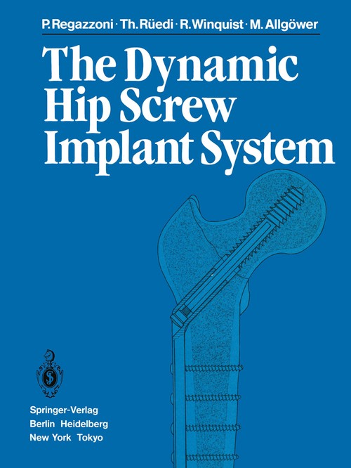 The Dynamic Hip Screw Implant System by P Regazzoni | ISBN-13 9783642699276
