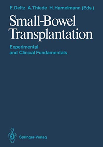 Small-Bowel Transplantation by Eberhard Deltz | ISBN-13 9783642710896