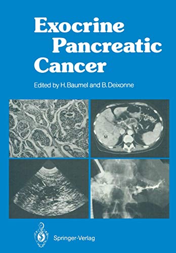Exocrine Pancreatic Cancer by Hughes Baumel | ISBN-13 9783642711800