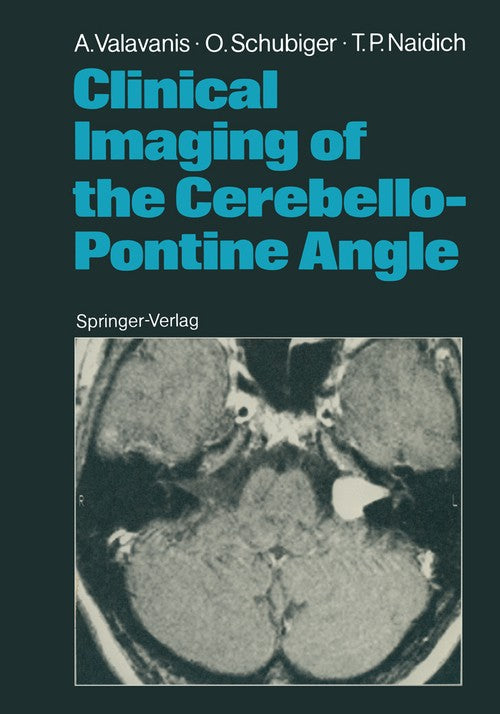 Clinical Imaging of the Cerebello-Pontine Angle by Anton Valavanis | ISBN-13 9783642712067