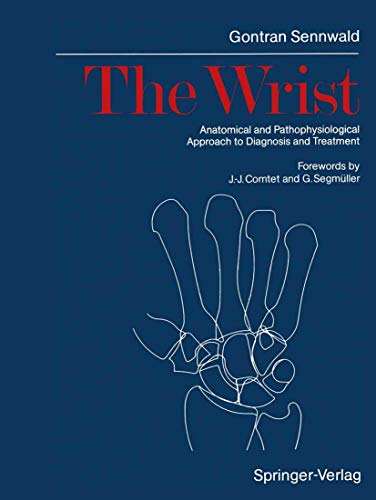 The Wrist by Gontran Sennwald | ISBN-13 9783642716249