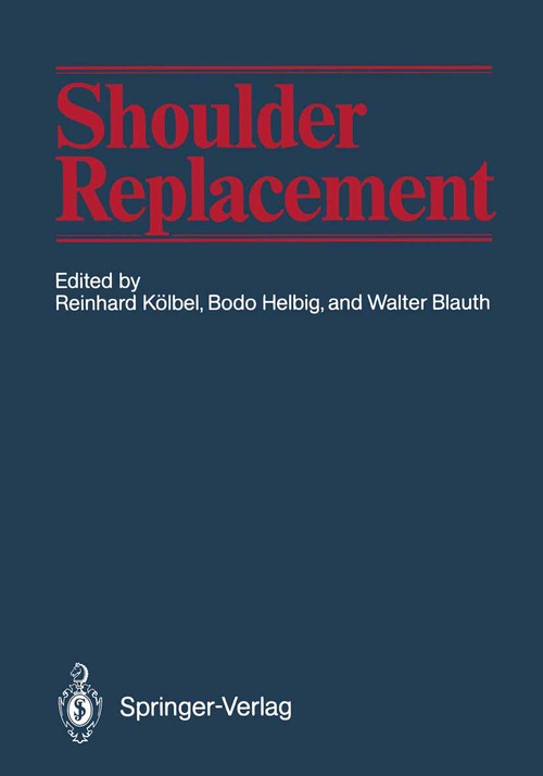 Shoulder Replacement by Reinhard Klbel ISBN 9783642716270