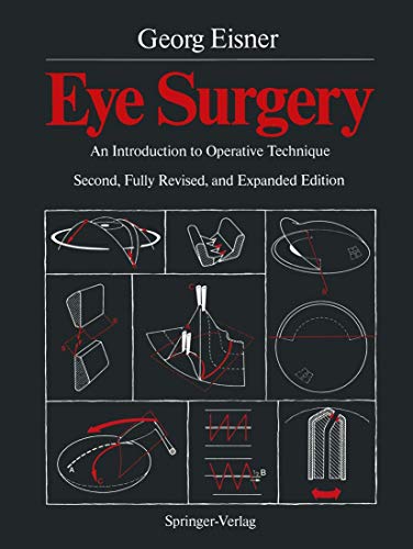 Eye Surgery by Terry C Telger | ISBN-13 9783642718014
