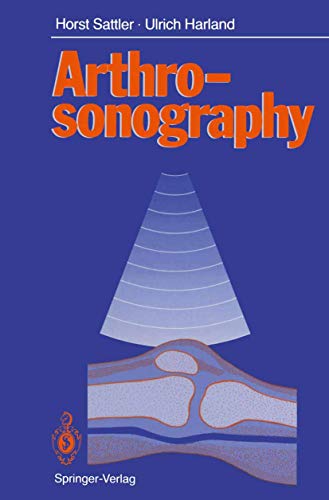 Arthrosonography by Horst Sattler | ISBN-13 9783642738692