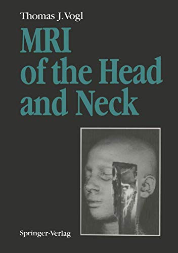 MRI of the Head and Neck by W Steger | ISBN-13 9783642767920