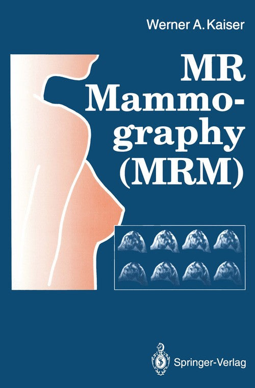 MR Mammography (MRM) by Werner A Kaiser | ISBN-13 9783642772580