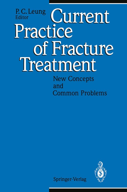 Current Practice of Fracture Treatment by Pc Leung | ISBN-13 9783642786051