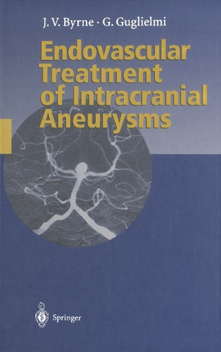 Endovascular Treatment of Intracranial Aneurysms by James Byrne | ISBN-13 9783642803833