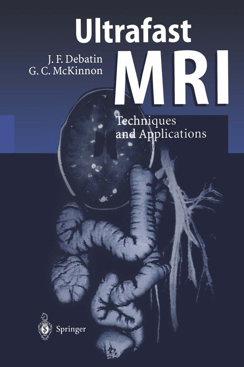 Ultrafast MRI by J-P Ranjeva | ISBN-13 9783642803864