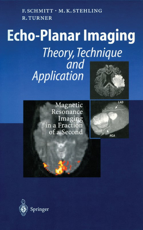 Echo-Planar Imaging by Franz Schmitt | ISBN-13 9783642804458