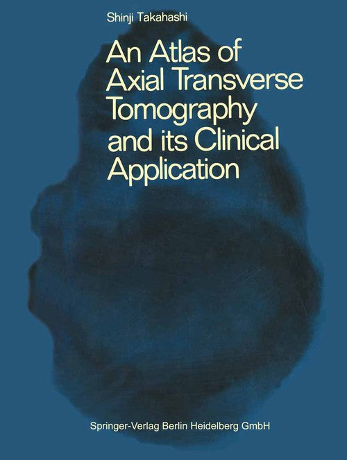 An Atlas of Axial Transverse Tomography and its Clinical Application by As Takahashi | ISBN-13 9783642855658