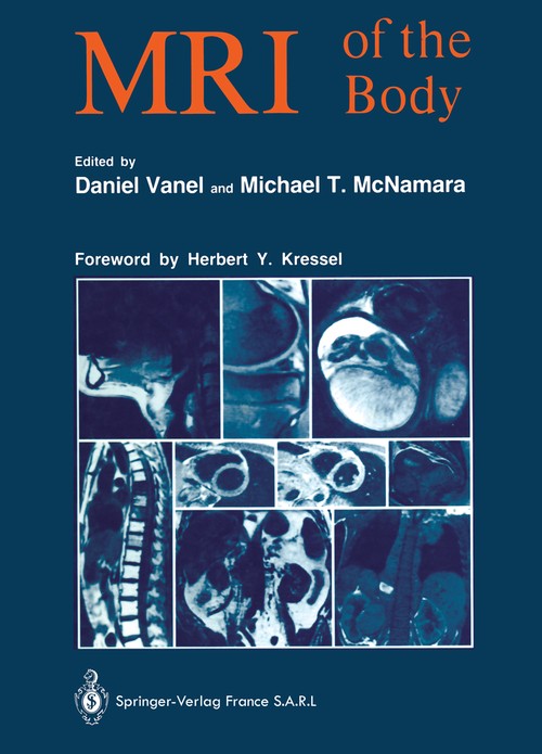 MRI of the Body by Daniel Vanel | ISBN-13 9783642875588