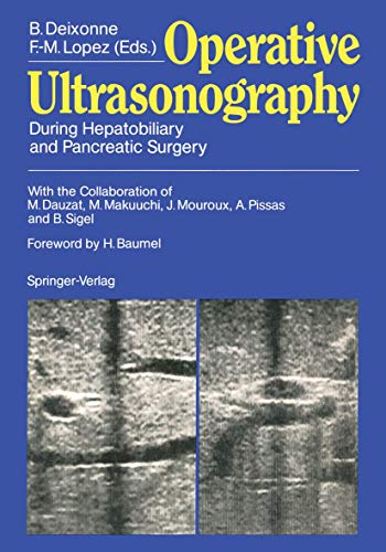 Operative Ultrasonography by M Dauzat | ISBN-13 9783642955242
