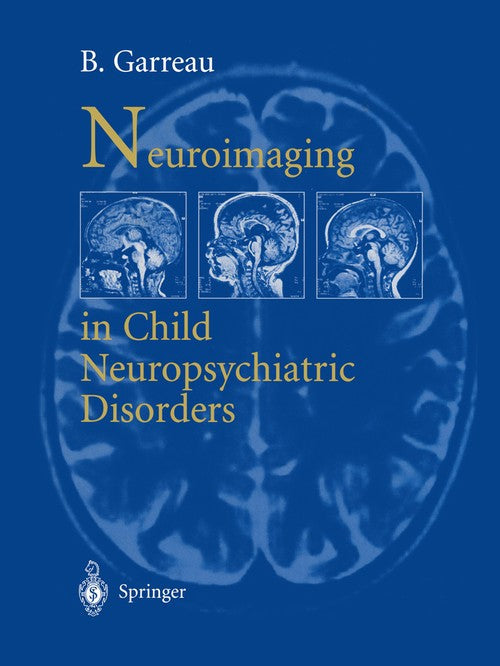 Neuroimaging in child neuropsychiatric disorders by B Garreau | ISBN-13 9783642958502
