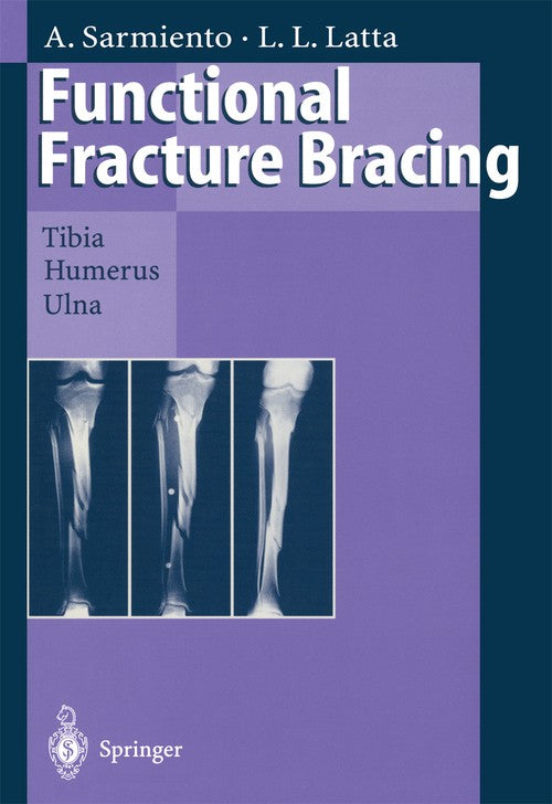 Functional Fracture Bracing by Augusto Sarmiento | ISBN-13 9783662030950