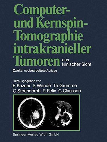 Computer- und Kernspin-Tomographie intrakranieller Tumoren aus klinischer Sicht by O Stochdorph | ISBN-13 9783662063873