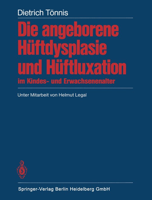 Congenital hip dysplasia and hip dislocation in childhood and adulthood by H Legal ISBN 9783662066225