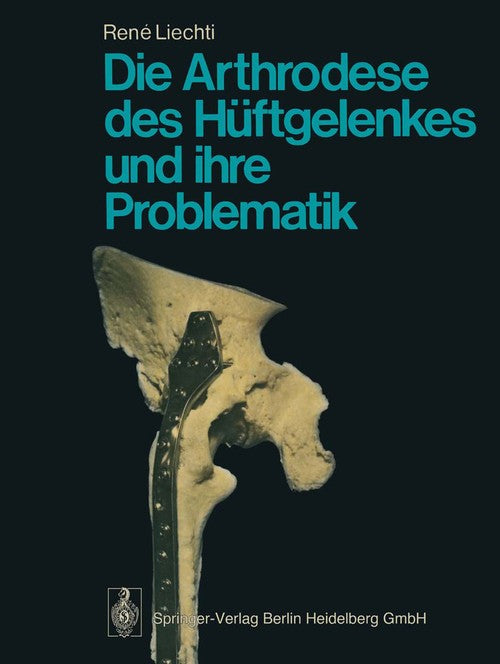 Arthrodesis of the hip joint and its problems by R Liechti ISBN 9783662066263