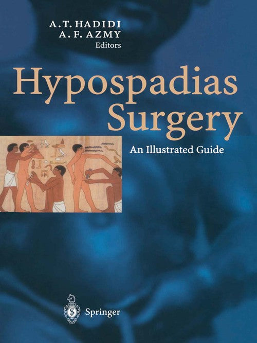 Hypospadias Surgery by Ahmed Hadidi | ISBN-13 9783662078433