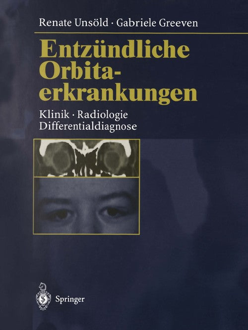 Entzündliche Orbitaerkrankungen by Gabriele Greeven | ISBN-13 9783662116852